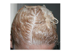 Auf-den-haare