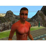 Sonnenbrand