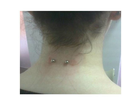 Mein-nape-nackenpiercing
